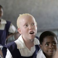 말라위에서 부자 되는 법 : 백색증 환자를 사냥하라?