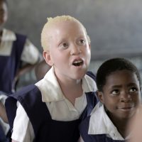 말라위: 2살된 알비노 어린이 살해, 보호받지 못하는 취약 집단