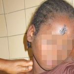 중앙아프리카공화국: 참상 속에서 살아남은 생명