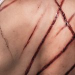 사우디아라비아: 채찍질 형 집행을 즉각 중단하라!